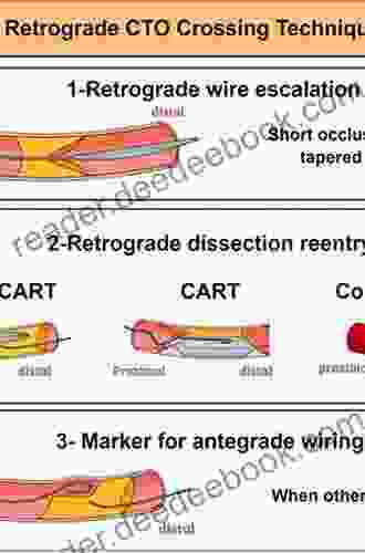 Current Trend And Techniques Of Percutaneous Coronary Intervention For Chronic Total Occlusion